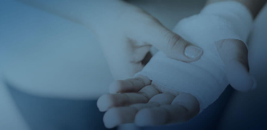 hands suffering burn injury